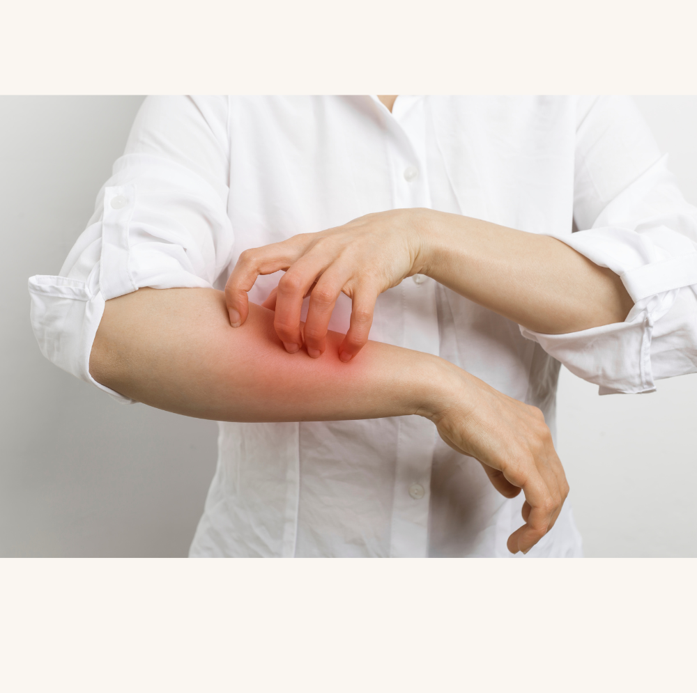 allergies and everything you need to know!