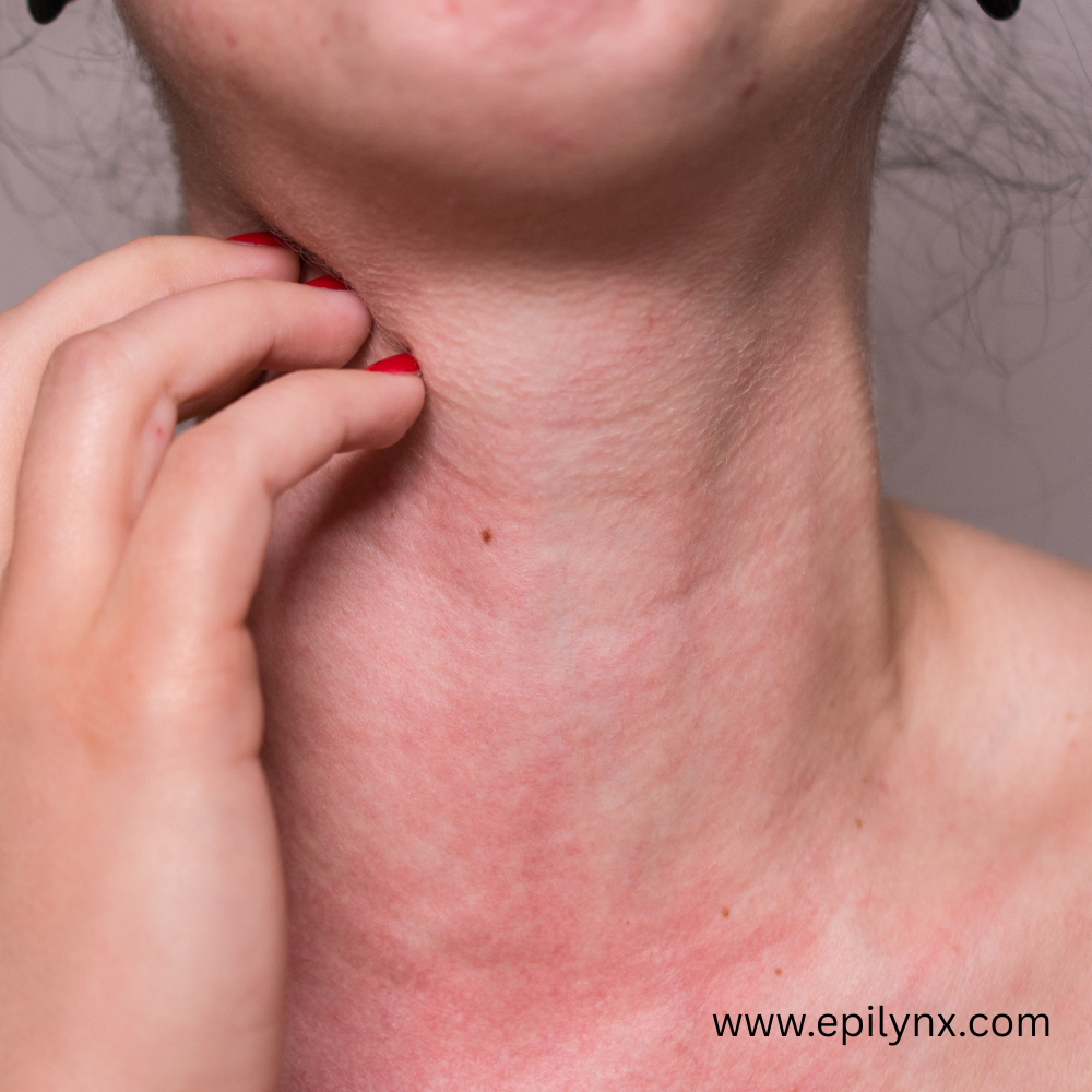 epilynx nut free skincare