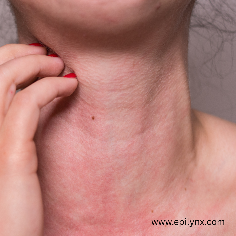Nickel Allergy and Your Beauty Routine: The World's Most Common Contact Allergen