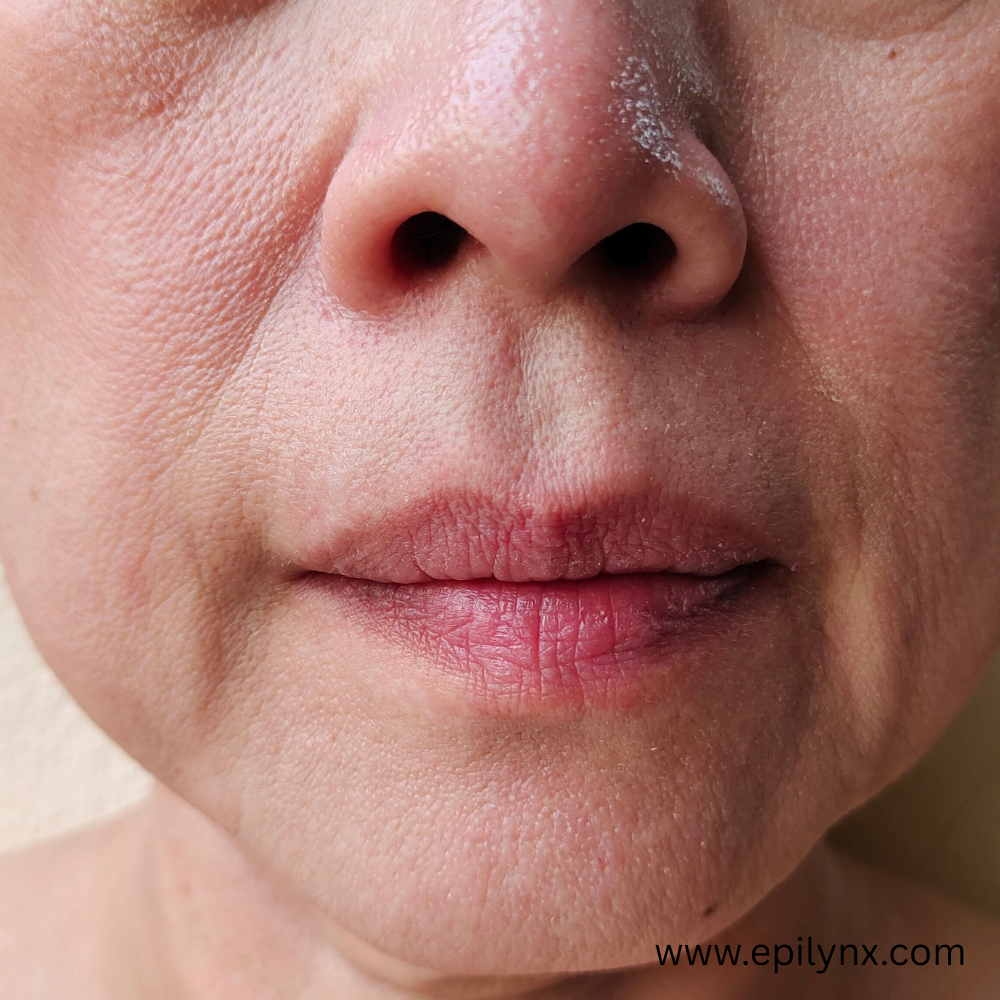 allergy aware skincare epilynx