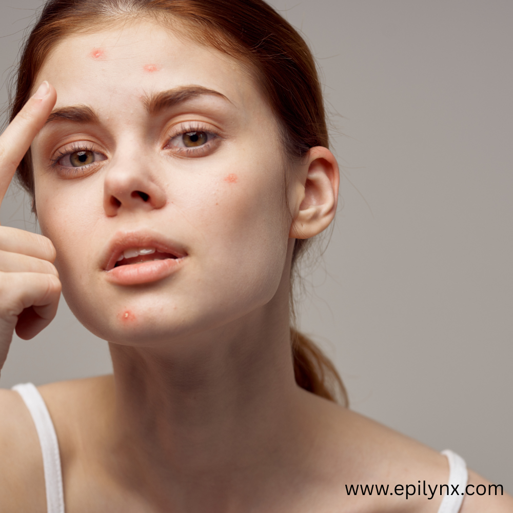 Why the hypoallergenic claim means little and what to look for instead
