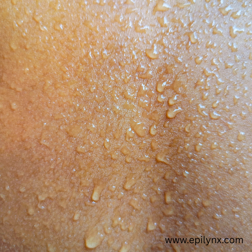 skincare and allergies