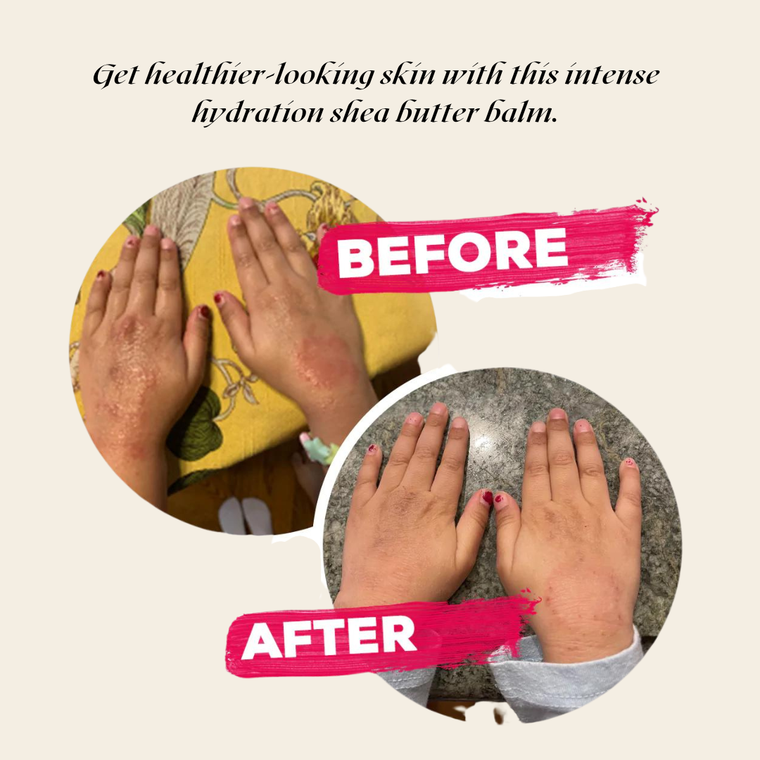 Velvet Hydration Body Balm ā Ultra-Rich, Vegan, Gluten-Free Moisture for Dry & Sensitive Skin