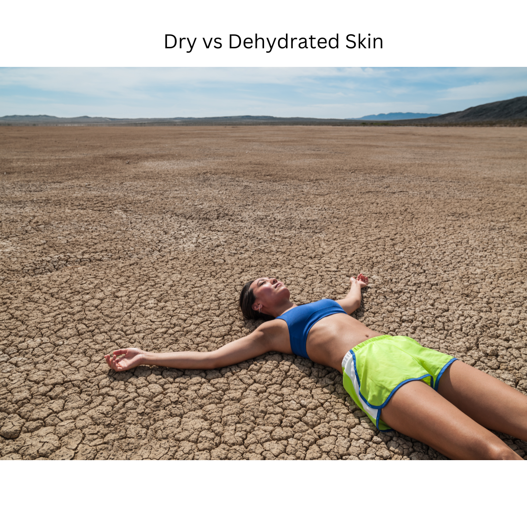 The difference between dry skin and dehydrated skin