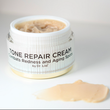 Hyperpigmentation